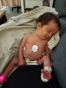 Photo of Charlotte on my lap on a pillow sleeping. All the moniotrs are on her and she has a nose tube in. 